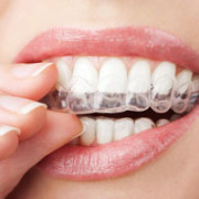 invisalign